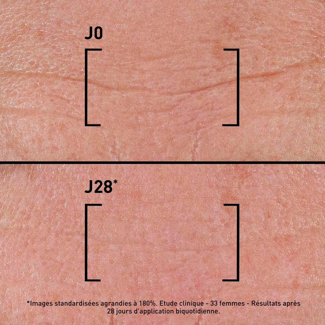 FILORGA TIME FILLER INTENSIVE